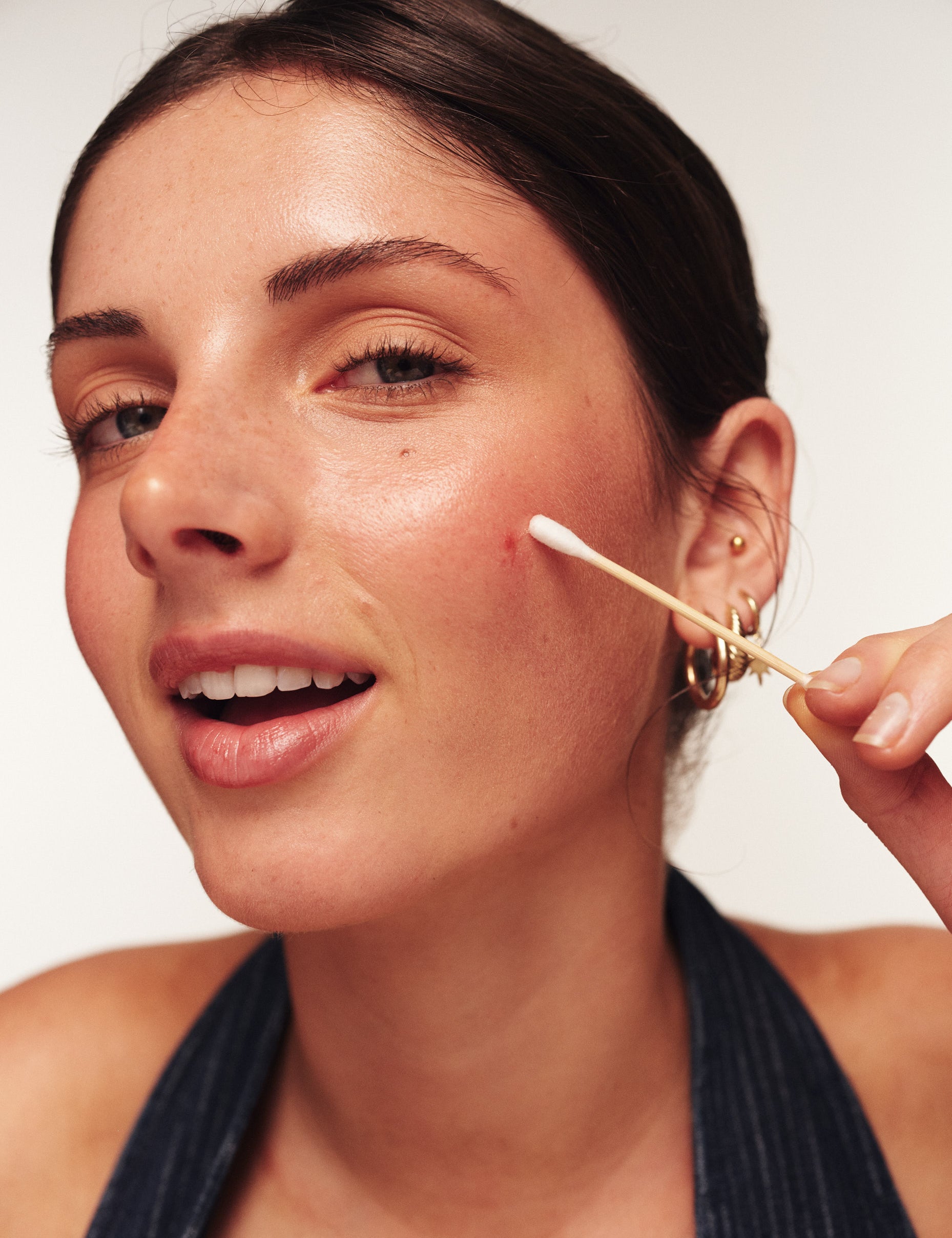 Pimple & Skin Care Brand