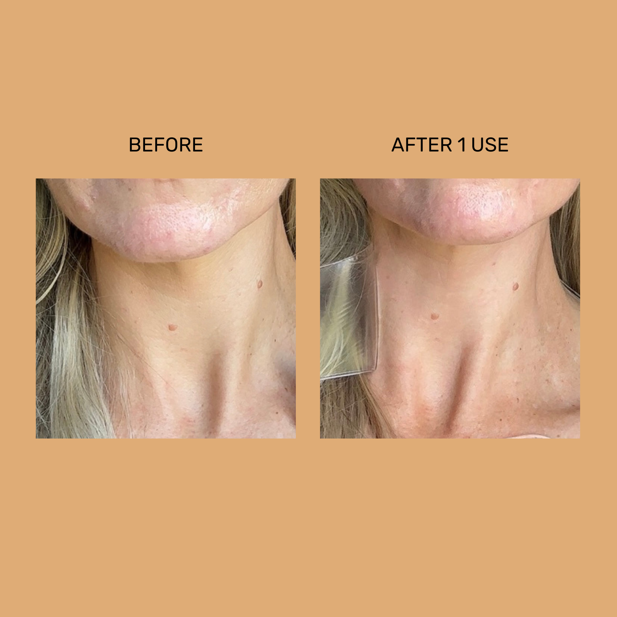 Pimple & Skin Care Brand